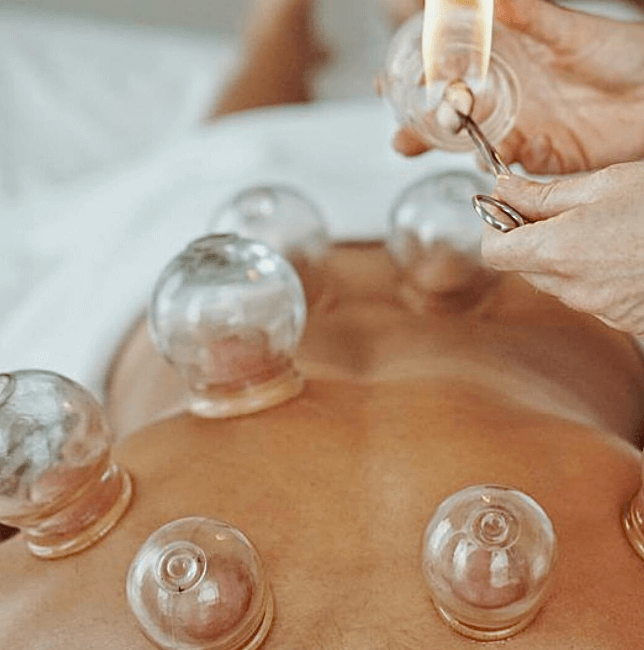 Bye bye cellulites: the art of Cupping